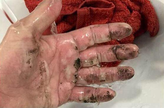 فتاة تشعل النيران في نفسها لافتضاح أمرها مع عشيقها بكفر الشيخ