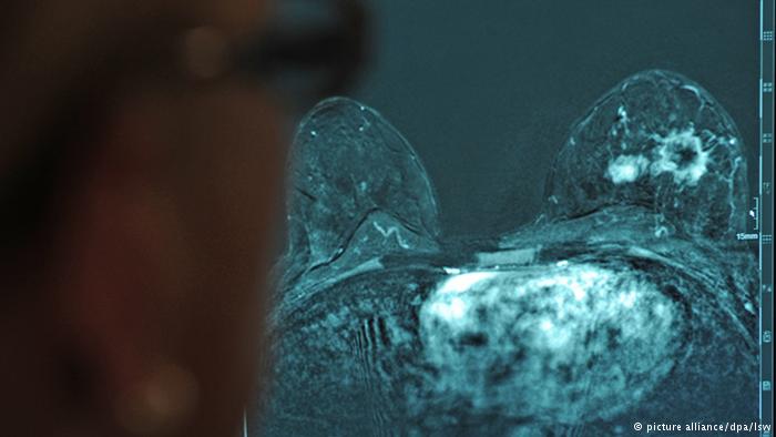 دراسة: مستويات فيتامين «د» مرتبطة بالشفاء من سرطان الثدي