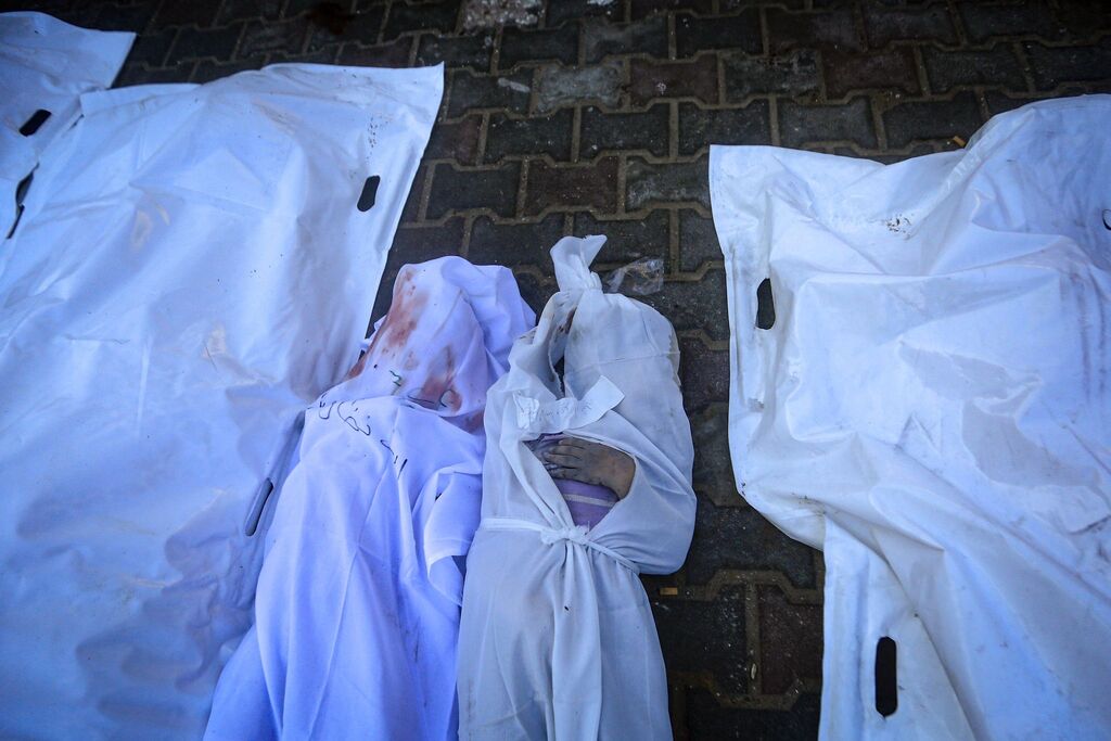 شهداء فلسطين في مستشفى الأقصى - د ب أ