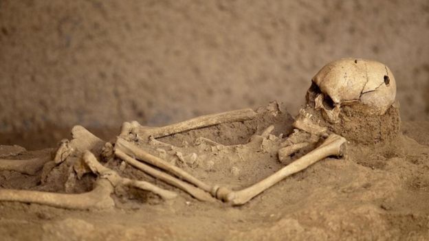 هيكل عظمي تبدو عليه بوضوح أثار عملية ثقب الجمجمة