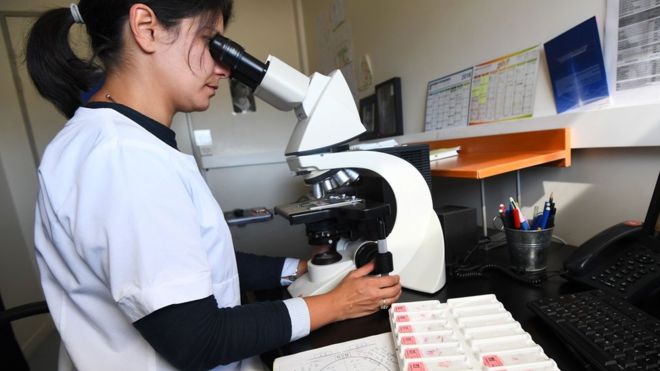 الدراسة توصي باستخدام معايير جديدة لاختبارات الجينات في النساء المصابات بسرطان الثدي