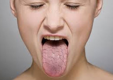 نصائح طبية لجفاف الفم والحلق وعلاج الصداع النصفي.  بوابة الشروق نسخة جوال