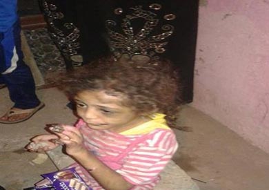الطفة ندى سيد التى قام ولدها بتعذيبها ببنى سويف