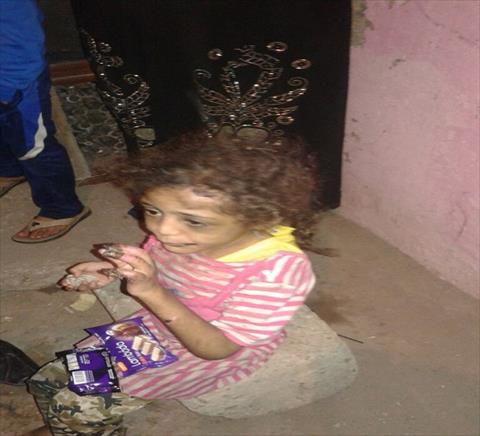 الطفلة ندى التى اقام والدها بتعذيبها ببنى سويف