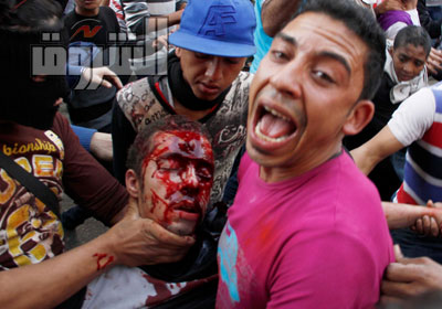 احد المصابين فى اشتباكات أمس الأول تصوير  أحمد عبداللطيف