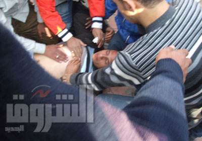 صورة لأحد المصابين - تصوير كريم عبد الكريم