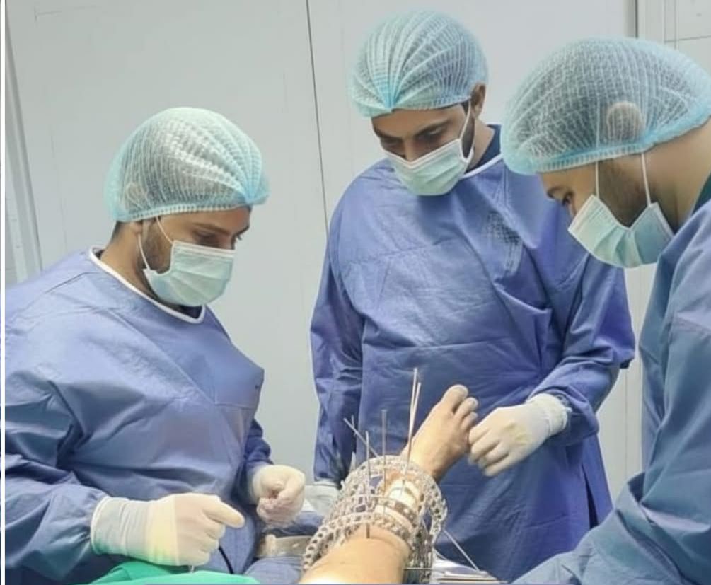 نجاح أول عملية تثبيت خارجي بجهاز إليزاروف لمريض مُسن بمستشفى الفكرية في المنيا 