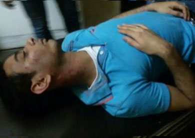 إصابات الحلاق طارق أحمد فرج في كمين الشرطة بطنطا