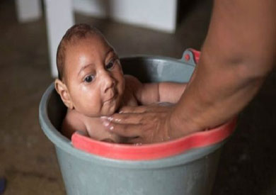 بلغ عدد الأطفال المصابين بصغر حجم الرأس في البرازيل حوالي 4000