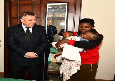 20 فبراير إجراء جراحة لفصل توأم بوراندي ملتصق بـ عين شمس التخصصي