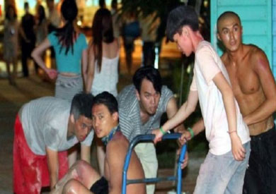 بعض الحضور ينقلون شابا أصيب بحروق في الساق إلى المستشفى